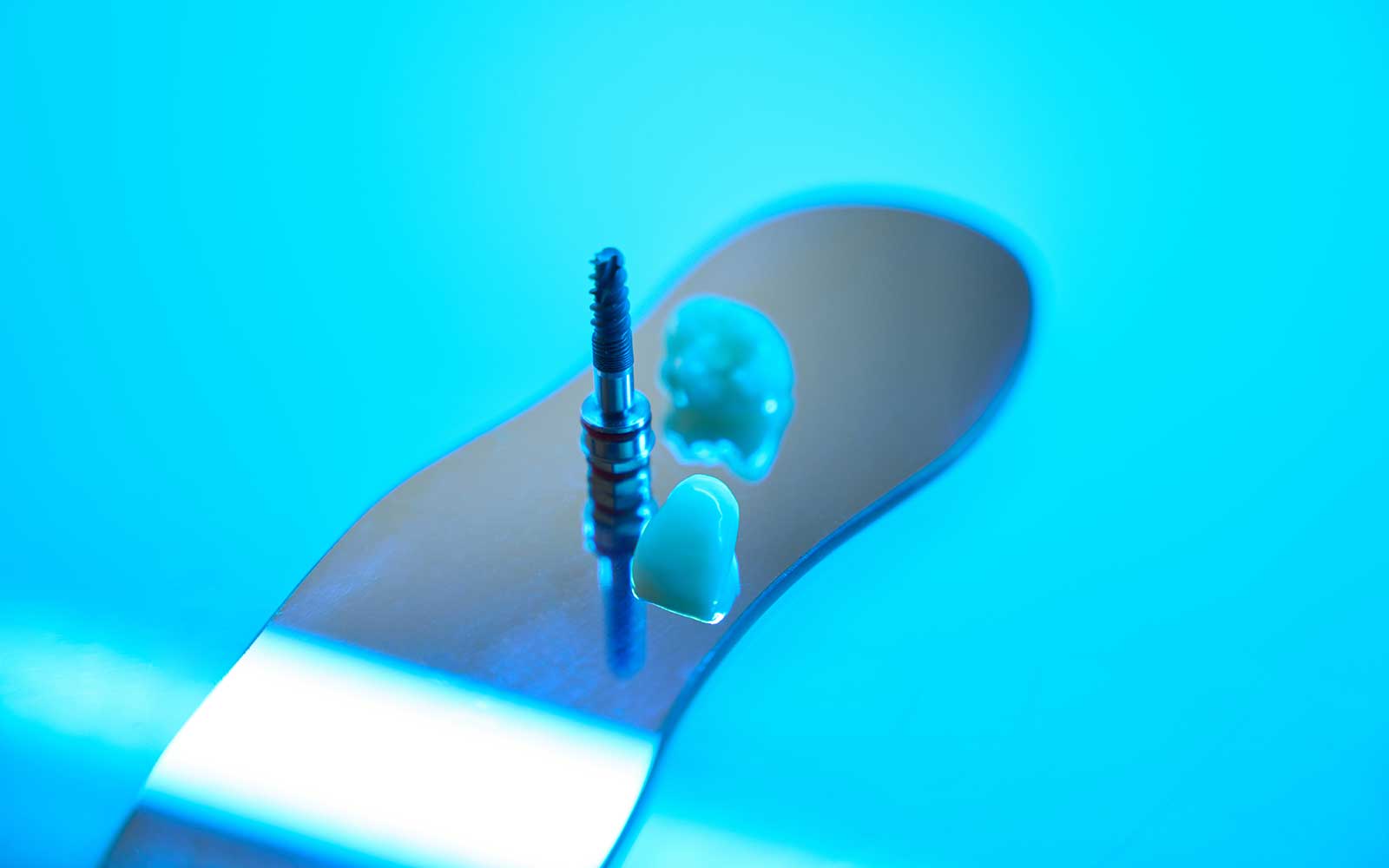 Dental Implants in Gladstone
