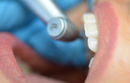 Dentist services