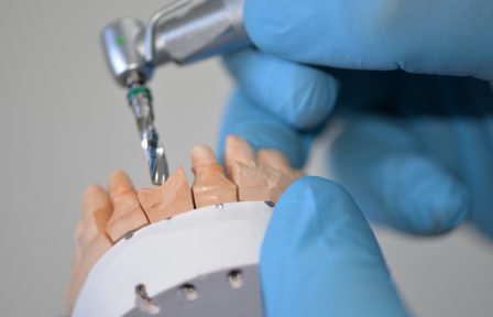 implant-supported crowns