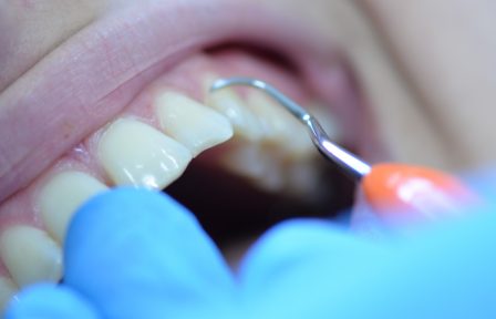 teeth