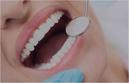 oral exmination
