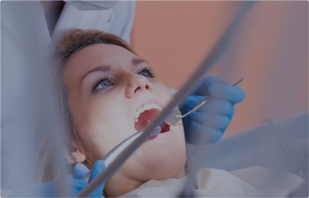 root canal