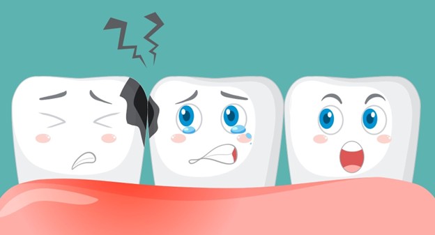 Cracked Tooth Symptoms